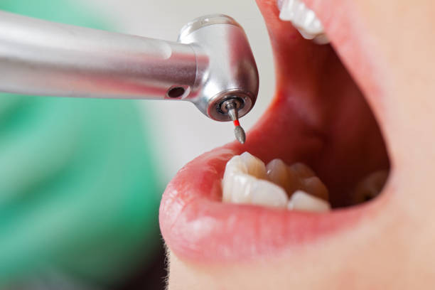 Best Emergency Treatment for Oral Infections in Chesapeake, VA
